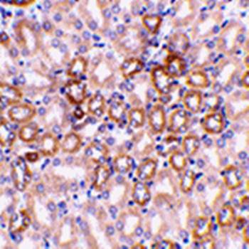 Nephrin Rabbit Polyclonal Antibody