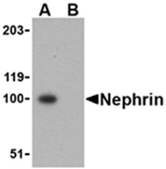Nephrin Rabbit Polyclonal Antibody