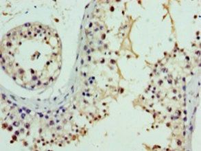 Nephrocystin-1 antibody