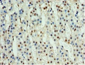 NPHP1 Antibody