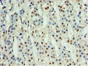 Nephrocystin-1 antibody