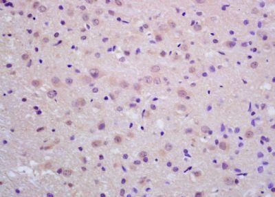 Neprilysin 2 Rabbit Polyclonal Antibody
