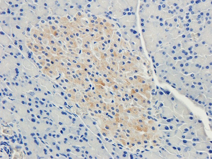 Nesprin 1 antibody