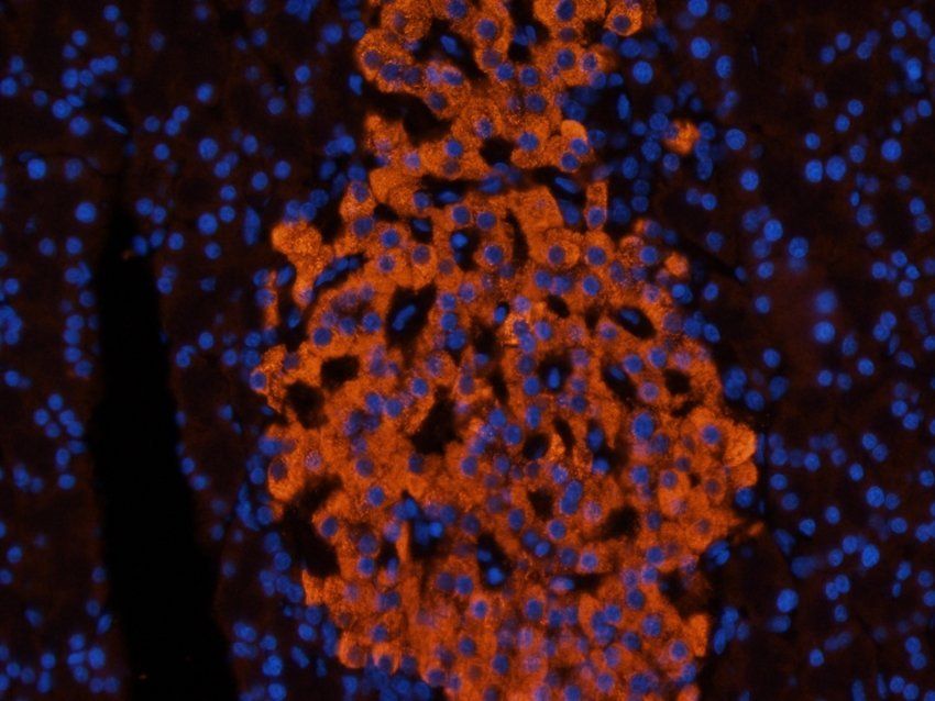 Nesprin 1 antibody