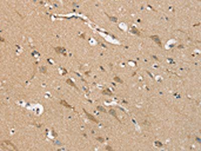 NES Antibody