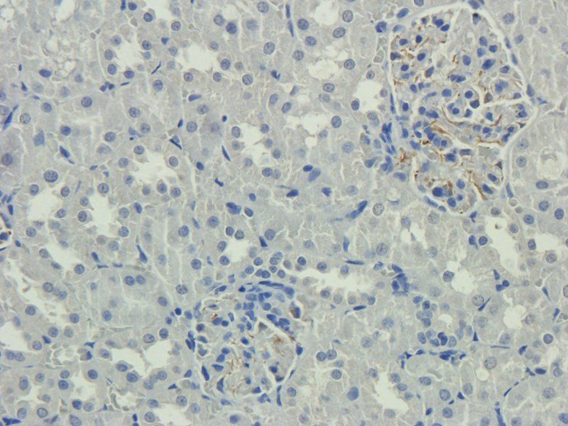 Nestin antibody