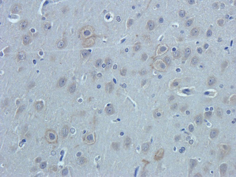 Nestin antibody