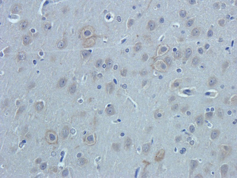 Nestin antibody