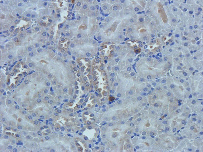 Nestin antibody