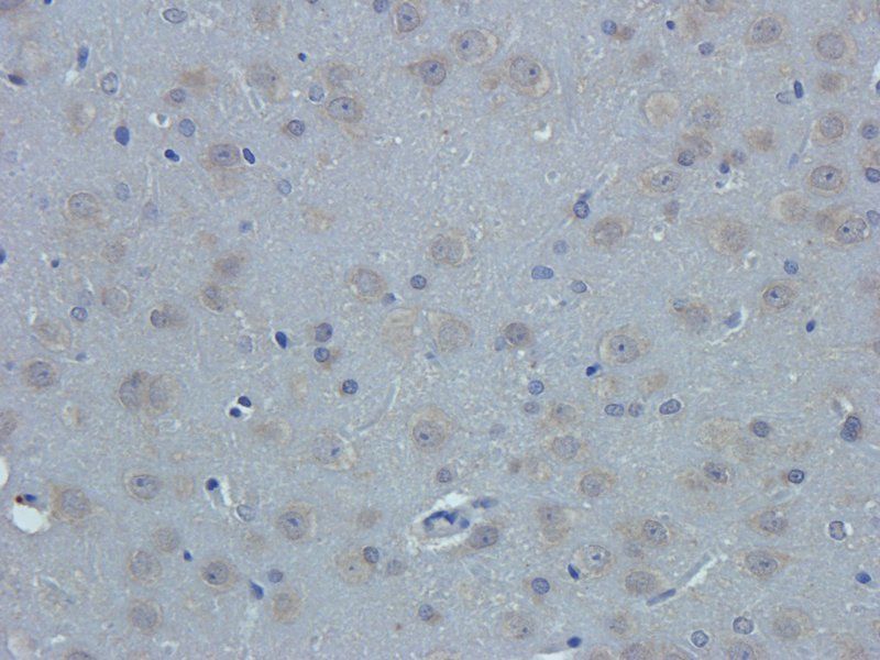 Nestin antibody