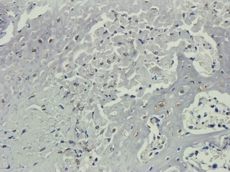 Nestin antibody