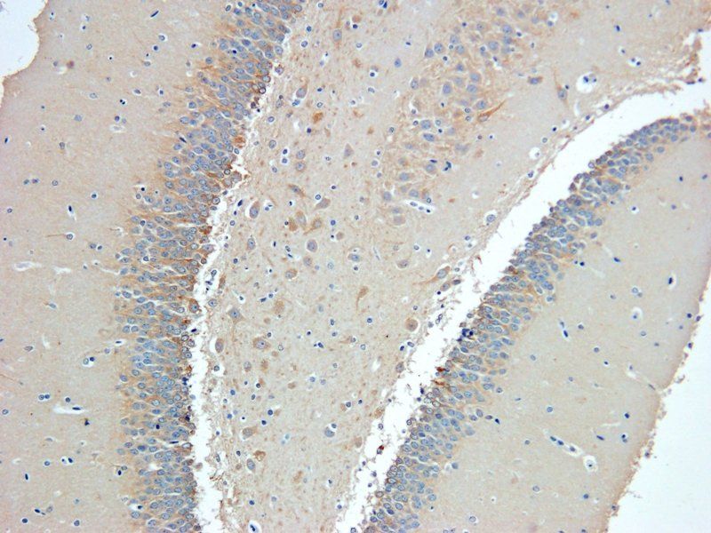 Nestin antibody