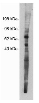 Rabbit Human Netrin 1 Antibody