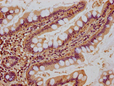 NEURL1B Antibody