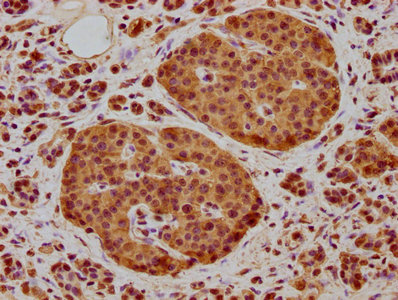 NEURL1B Antibody