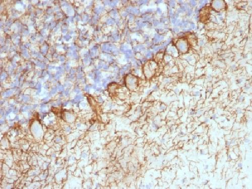 Neurofilament (H+L) antibody