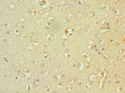 TACR3 Antibody