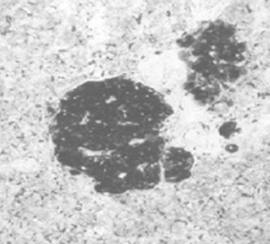 Mouse Human Enolase Antibody