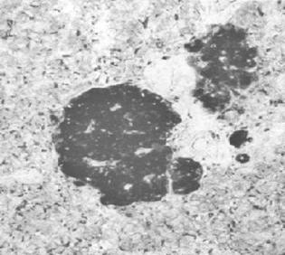 Mouse Human Neuron-Specific Enolase Antibody