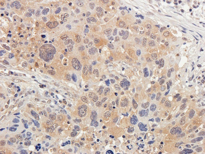 Neuroplastin antibody