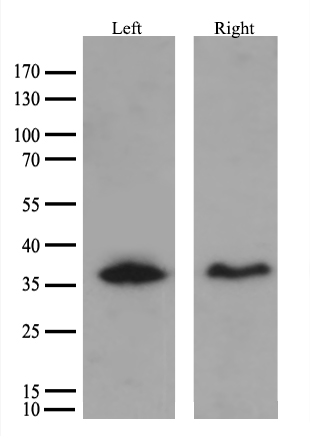 Neuroserpin Antibody