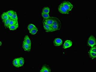 Neutrophil Elastase antibody