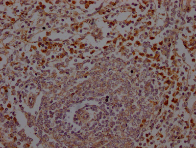 Neutrophil Elastase antibody
