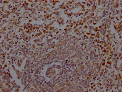 ELANE Recombinant Monoclonal Antibody