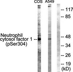 Neutrophil Cytosol Factor 1 (Phospho-Ser304) Antibody