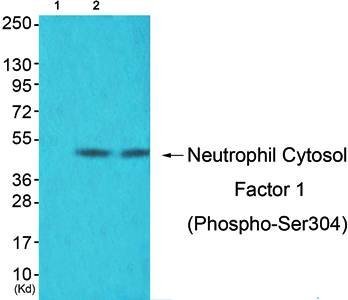Neutrophil Cytosol Factor 1 (Phospho-Ser304) Antibody