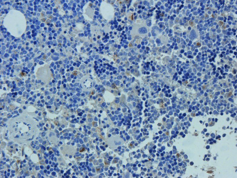 Neutrophil Elastase antibody