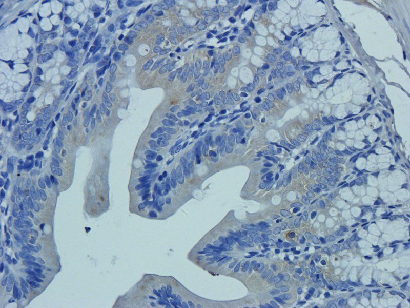 Neutrophil Elastase antibody