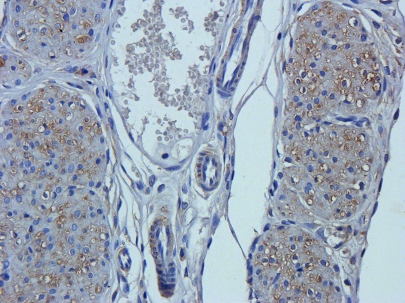 Neutrophil Elastase antibody