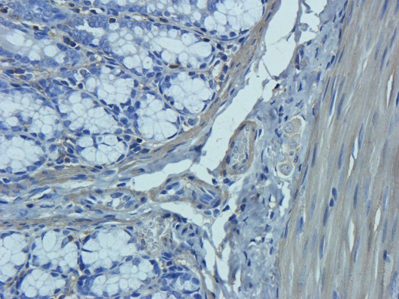 Neutrophil Elastase antibody