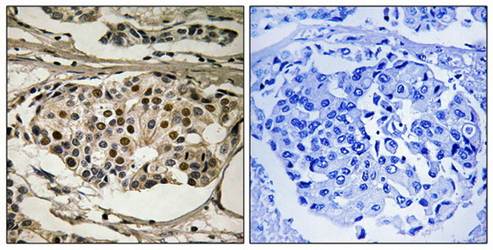 NF-κB p65 (Phospho-Ser281) Antibody