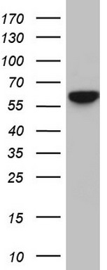 NF-kB p65 Antibody