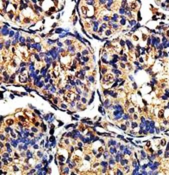 ZNF540 Rabbit Polyclonal Antibody