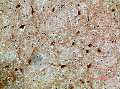NFAT5 Antibody