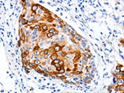 NFATC1 Antibody