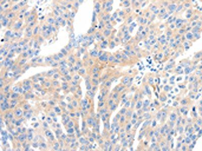 NFATC2 Antibody