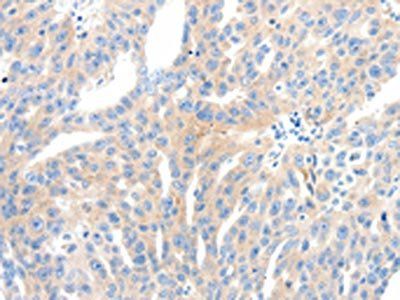 NFATC2 antibody