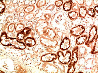 NFE2L2 Antibody