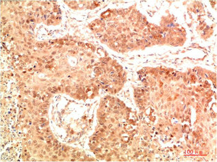 NFE2L2 Antibody