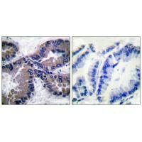 NFE2L2 Antibody