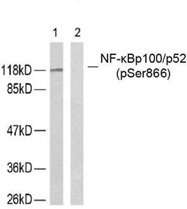 NFκB-p100/p52(Phospho-Ser866) Antibody