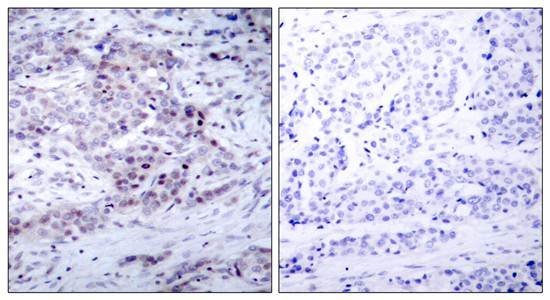 NFκB-p100/p52(Phospho-Ser870) Antibody