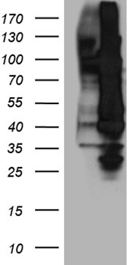 NFkB p100/p52 Antibody