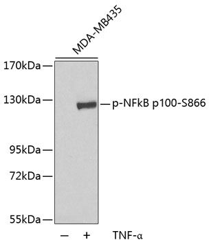 NFkB p100 (Phospho-S866) antibody