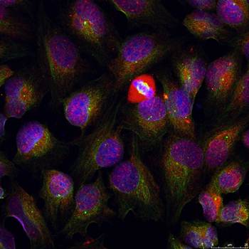 NFκB-p105/p50(Phospho-Ser337) Antibody