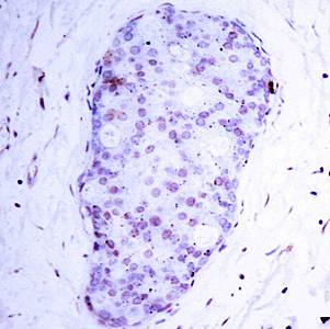 NFκB-p105/p50(Phospho-Ser907) Antibody
